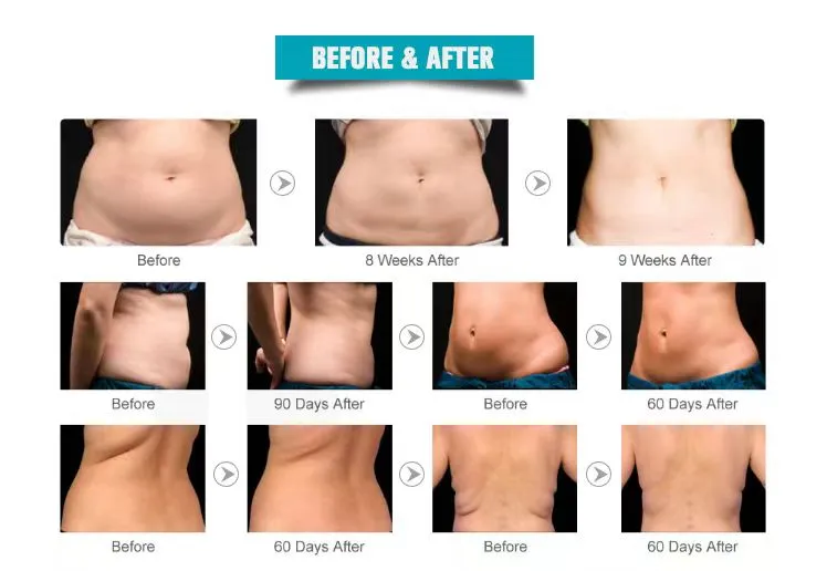 using chart using chart